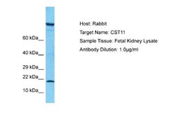 cystatin 11 Rabbit anti-Human, Polyclonal, Novus Biologicals 0.1ml; Unconjugated:Antibodies,